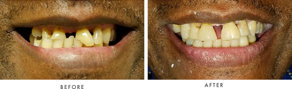 cosmetic bonding dr gamburg